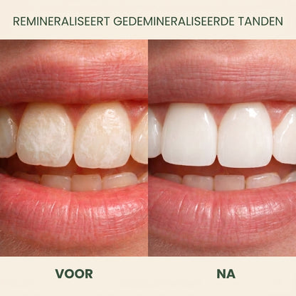 Holariss remineraliserende kauwgom 5
